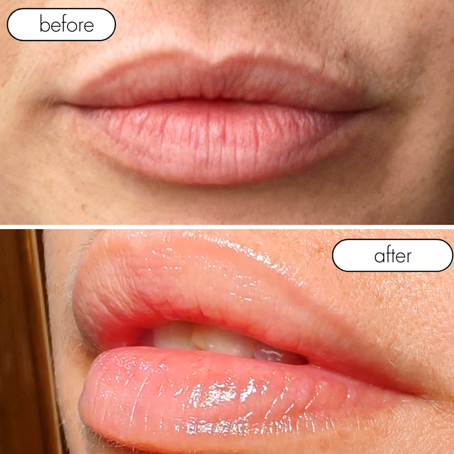 Bálsamo Labial Natural - Besos de Verano